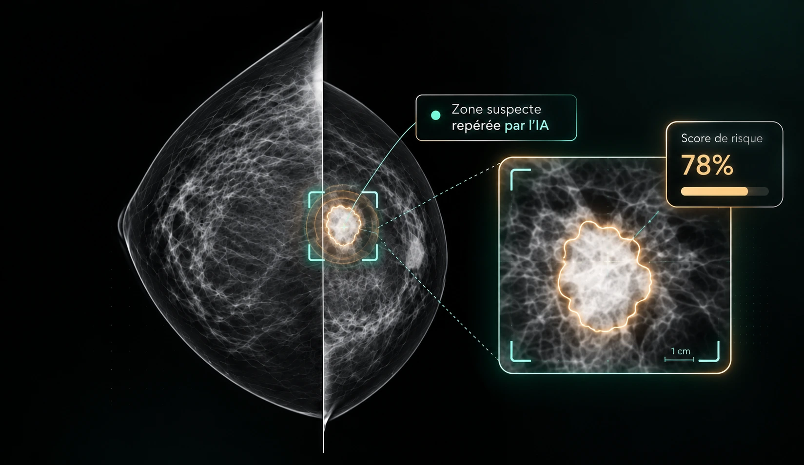 Intelligence artificielle appliquée à l'imagerie médicale
